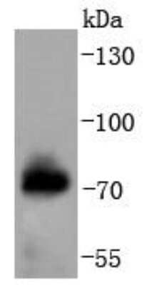 Western Blot: Raf-1 [p Ser621] Antibody (JJ085-05) [NBP2-67855] - Western blot analysis of Raf-1 on human skeletal muscle lysates using anti-Raf-1 antibody at 1/1,000 dilution.