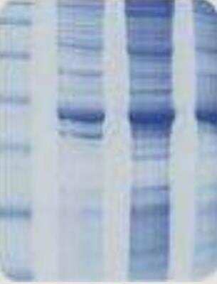 SDS-Page: Raji Whole Cell Lysate [NB820-59466] - Protein lysate shows consistent pattern.