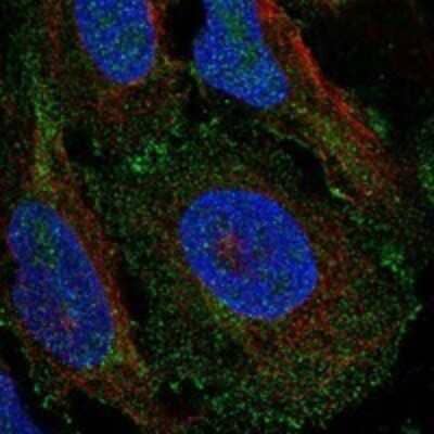 Immunocytochemistry/Immunofluorescence: RalA/RalB Antibody [NBP3-17302] - Staining of human cell line U-2 OS shows localization to plasma membrane.