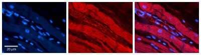 Immunohistochemistry: RalA/RalB Antibody [NBP1-79633] - Formalin Fixed Paraffin Embedded Tissue: Human heart Tissue Observed Staining: Cytoplasmic in endothelial cells in blood vessels, plasma membrane in cardiomyocytes Primary Antibody Concentration: 1:100 Other Working Concentrations: 1:600 Secondary Antibody: Donkey anti-Rabbit-Cy3 Secondary Antibody Concentration: 1:200 Magnification: 20X Exposure Time: 0.5 - 2.0 sec
