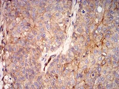Immunohistochemistry RalB Antibody (7F8B4) - BSA Free