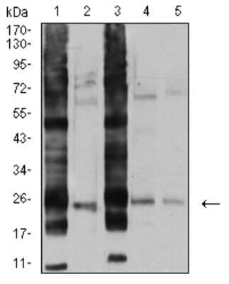 Western Blot: RalB Antibody (8A8A9) [NBP2-61826] - Analysis using RALB mouse mAb against A549 (1), U251 (2), HT-29 (3), HEK293 (4), and LOVO (5) cell lysate.