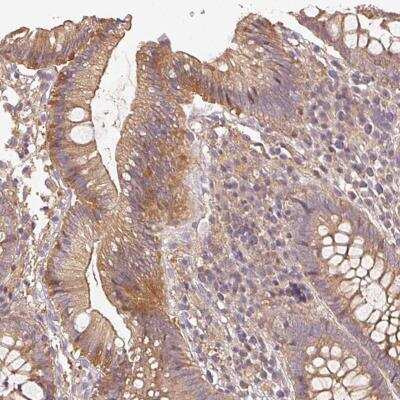 Immunohistochemistry: RalB Antibody [NBP2-46872] - Staining of human colon shows moderate cytoplasmic and luminal membranous positivity in glandular cells.