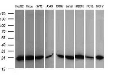 Western Blot: RalB Antibody (OTI2C4) - Azide and BSA Free [NBP2-73785] - Analysis of extracts (35ug) from 9 different cell lines (HepG2: human; HeLa: human; SVT2: mouse; A549: human; COS7: monkey; Jurkat: human; MDCK: canine; PC12: rat; MCF7: human).