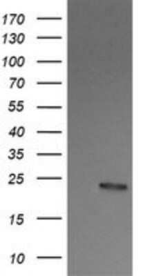 Western Blot: RalB Antibody (OTI2C4) - Azide and BSA Free [NBP2-73785] - Analysis of HEK293T cells were transfected with the pCMV6-ENTRY control (Left lane) or pCMV6-ENTRY RALB.