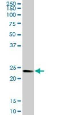 Western Blot: RalB Antibody [H00005899-B01P] - Analysis of RALB expression in human placenta.