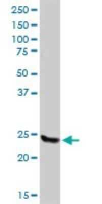 Western Blot: RalB Antibody [H00005899-D01P] - Analysis of RALB expression in human kidney.