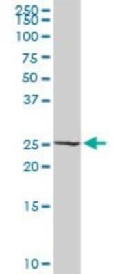 Western Blot: RalB Antibody [H00005899-D01P] - Analysis of RALB expression in mouse lung.