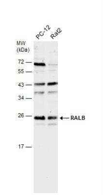 Western Blot: RalB Antibody [NBP1-32696] - Various whole cell extracts (30 ug) were separated by 12% SDS-PAGE, and the membrane was blotted with RALB antibody [N1C3] diluted at 1:500.