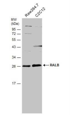 Western Blot: RalB Antibody [NBP1-32696] - Various whole cell extracts (30 ug) were separated by 12% SDS-PAGE, and the membrane was blotted with RALB antibody [N1C3]  diluted at 1:500.