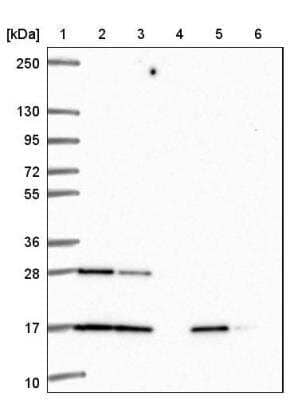 Western Blot: RalB Antibody [NBP2-46872] - Lane 1: Marker  [kDa] 250, 130, 95, 72, 55, 36, 28, 17, 10, Lane 2: Human cell line RT-4, Lane 3: Human cell line U-251 MG, Lane 4: Human plasma, Lane 5: Human Analysis of human liver tissue., Lane 6: Human Tonsil tissue