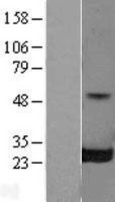 Western Blot: RalB Overexpression Lysate (Adult Normal) [NBL1-15131] Left-Empty vector transfected control cell lysate (HEK293 cell lysate); Right -Over-expression Lysate for RalB.