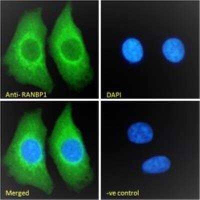 Immunocytochemistry/Immunofluorescence: RanBP1 Antibody [NB100-1443] - Immunofluorescence analysis of paraformaldehyde fixed HEK293 cells, permeabilized with 0.15% Triton. Primary incubation 1hr (10ug/ml) followed by Alexa Fluor 488 secondary antibody (2ug/ml), showing cytoplasmic staining. The nuclear stain is DAPI (blue). Negative control: Unimmunized goat IgG (10ug/ml) followed by Alexa Fluor 488 secondary antibody (2ug/ml).