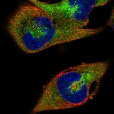 <b>Orthogonal Strategies Validation. </b>Immunocytochemistry/Immunofluorescence: RanBP1 Antibody [NBP2-57339] - Staining of human cell line RH-30 shows localization to cytosol.