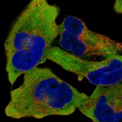 Immunocytochemistry/Immunofluorescence: RanBP1 Antibody [NBP2-57585] - Staining of human cell line RH-30 shows localization to cytosol.