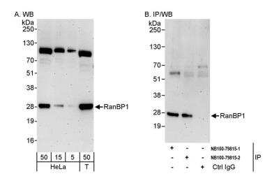 Immunoprecipitation: RanBP1 Antibody [NB100-79815] - Detection of human RanBP1 by western blot and immunoprecipitation. Samples: Whole cell lysate from HeLa (5, 15 and 50 ug for WB; 1 mg for IP, 20% of IP loaded) and HEK293T (T; 50 ug) cells. Antibodies: Affinity purified rabbit anti-RanBP1 antibody NB100-79815 (lot 2) used for WB at 0.4 ug/ml (A) and 1 ug/ml (B) and used for IP at 3 ug/mg lysate. RanBP1 was also immunoprecipitated by the previous lot (lot 1) of this antibody. Detection: Chemiluminescence with exposure times of 3 minutes (A and B)