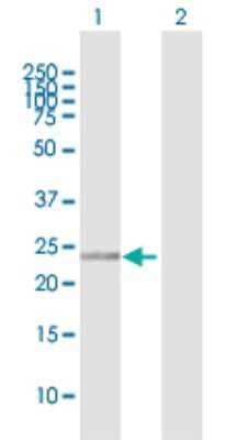 Western Blot: RanBP1 Antibody [H00005902-D01P] - Analysis of RANBP1 expression in transfected 293T cell line by RANBP1 polyclonal antibody.Lane 1: RANBP1 transfected lysate(22.11 KDa).Lane 2: Non-transfected lysate.