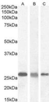 Western Blot: RanBP1 Antibody [NB100-1443] - Staining of A431 (A) with antibody at 0.03 ug/mL, HeLa (B) with antibody at 0.5 ug/mL and MCF7 (C) cell lysate with antibody at 0.1 ug/mL (35ug protein in RIPA buffer). Detected by chemiluminescence.