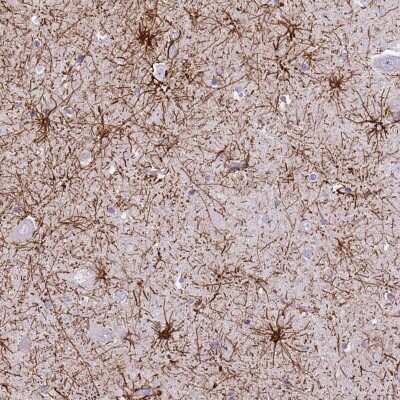 Immunohistochemistry: RanBP16 Antibody [NBP2-48893] - Staining of human hippocampus shows strong cytoplasmic positivity in astrocytes.