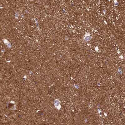 Immunohistochemistry-Paraffin: RanBP16 Antibody [NBP2-48800] - Staining of human hippocampus shows positivity in neuropil.