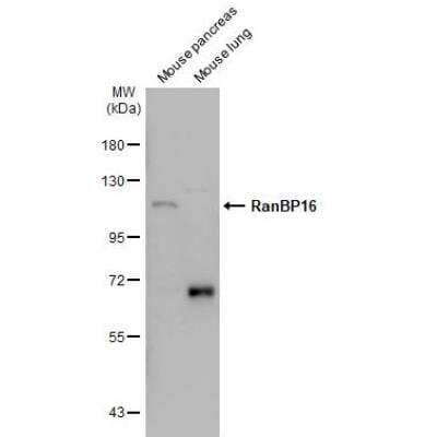 Western Blot: RanBP16 Antibody [NBP1-32350] - Various tissue extracts (50 ug) were separated by 7.5% SDS-PAGE, and the membrane was blotted with RanBP16 antibody [C2C3], C-term diluted at 1:500. The HRP-conjugated anti-rabbit IgG antibody (NBP2-19301) was used to detect the primary antibody.