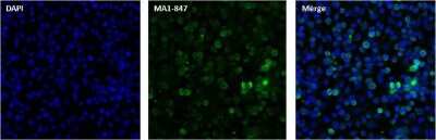 Immunocytochemistry/Immunofluorescence: RanBP2 Antibody (2E1) [NB100-74480] - Analysis of Nup358 (green) in HeLa cells. Cells were fixed with 4% paraformaldehyde, permeabilized with 0.1% Triton X-100 in PBS, and blocked with 1% Blocker BSA in PBS, each for 15 minutes at room temperature. Cells were stained with a Nup358 monoclonal antibody at a concentration of 10ug/ml in 1% Blocker BSA in PBS, followed by a DyLight 488-conjugated goat anti-mouse IgG secondary antibody at a dilution of 1:1000 for 1 hour at room temperature. Nuclei (blue) were stained with DAPI. Images were taken on a Thermo Scientific ToxInsight Instrument at 20X magnification.