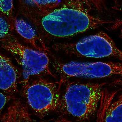 Immunocytochemistry/Immunofluorescence: RanBP2 Antibody [NBP2-56520] - Staining of human cell line CACO-2 shows localization to nuclear membrane & vesicles.