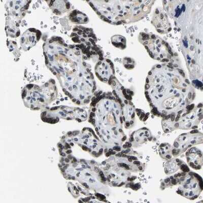 Immunohistochemistry: RanBP2 Antibody [NBP2-33881] - Staining of human placenta shows strong nuclear membrane positivity in trophoblastic cells.