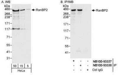 <b>Independent Antibodies Validation. </b>Western Blot: RanBP2 Antibody [NB100-93337] - Detection of Human RanBP2 on HeLa whole cell lysate using NB100-93337. RanBP2 was also  immunoprecipitated by rabbit anti-RanBP2 antibody NB100-93338.