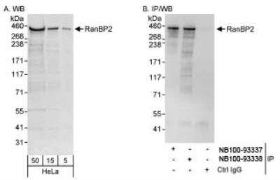 Western Blot: RanBP2 Antibody [NB100-93338] - Detection of Human RanBP2 on HeLa whole cell lysate using NB100-93338. RanBP2 was also  immunoprecipitated by rabbit anti-RanBP2 antibody NB100-93337.