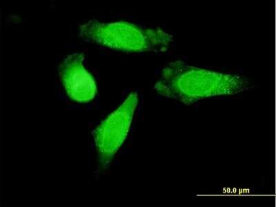 Immunocytochemistry/Immunofluorescence: RanGAP1 Antibody [H00005905-B01P] - Analysis of purified antibody to RANGAP1 on HeLa cell. (antibody concentration 10 ug/ml)