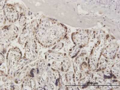 Immunohistochemistry-Paraffin: RanGAP1 Antibody [H00005905-B01P] - Analysis of purified antibody to RANGAP1 on formalin-fixed paraffin-embedded human placenta. (antibody concentration 3 ug/ml)