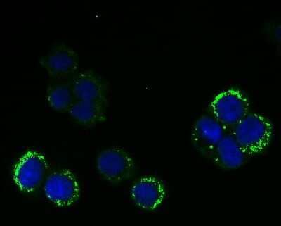 Immunocytochemistry/Immunofluorescence: RanGAP1 Antibody (JG37-41) [NBP2-76865] - ICC staining RanGAP1 (green) in 293T cells. The nuclear counter stain is DAPI (blue). Cells were fixed in paraformaldehyde, permeabilised with 0.25% Triton X100/PBS.