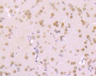 Immunohistochemistry: RanGAP1 Antibody (JG37-41) [NBP2-76865] - Immunohistochemical analysis of paraffin-embedded mouse brain tissue using anti-RanGAP1 antibody. Counter stained with hematoxylin.