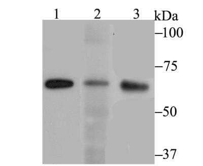 Western Blot: RanGAP1 Antibody (JG37-41) [NBP2-76865] - Western blot analysis of RanGAP1 on different cell lysates using anti-RanGAP1 antibody at 1/1,000 dilution.Positive control:Lane 1: MCF-7Lane 2: SiHa Lane 3: 293