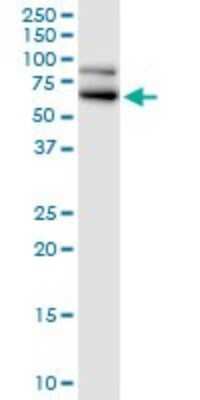Western Blot: RanGAP1 Antibody [H00005905-B01P] - Analysis of RANGAP1 expression in Jurkat.
