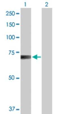 Western Blot: RanGAP1 Antibody [H00005905-B01P] - Analysis of RANGAP1 expression in transfected 293T cell line by RANGAP1 polyclonal antibody.  Lane 1: RANGAP1 transfected lysate(64.57 KDa). Lane 2: Non-transfected lysate.