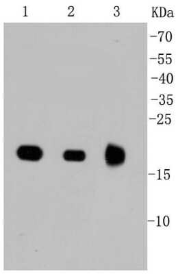 Western Blot: Ras Antibody (SA39-05) [NBP2-67290] - Analysis of Ras on different lysates using anti-Ras antibody at 1/1,000 dilution. Positive control: Lane 1: MCF-7  Lane 2: 293T Lane 3: Mouse brain