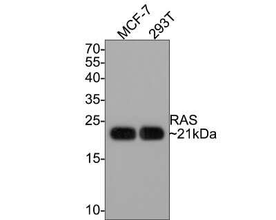 Western Blot: Ras Antibody (SA39-05) [NBP2-67290] - Analysis of Ras on different lysates with Rabbit anti-Ras antibody at 1/500 dilution. Lane 1: MCF-7 cell lysateLane 2: 293T cell lysate.Lysates/proteins at 10 ug/Lane.Predicted band size: 21 kDaObserved band size: 21 kDa. Exposure time: 2 minutes; 15% SDS-PAGE gel. Proteins were transferred to a PVDF membrane and blocked with 5% NFDM/TBST for 1 hour at room temperature. The primary antibody at 1/500 dilution was used in 5% NFDM/TBST at room temperature for 2 hours. Goat Anti-Rabbit IgG - HRP Secondary Antibody at 1:300,000 dilution was used for 1 hour at room temperature.