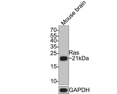 Western Blot: Ras Antibody (SA39-05) [NBP2-67290] - Analysis of Ras on mouse brain tissue lysates with Rabbit anti-Ras antibody at 1/2,000 dilution. Lysates/proteins at 20 ug/Lane. Predicted band size: 21 kDa Observed band size: 21 kDa Exposure time: 2 minutes; 15% SDS-PAGE gel. Proteins were transferred to a PVDF membrane and blocked with 5% NFDM/TBST for 1 hour at room temperature. The primary antibody at 1/2,000 dilution was used in 5% NFDM/TBST at room temperature for 2 hours. Goat Anti-Rabbit IgG - HRP Secondary Antibody at 1:300,000 dilution was used for 1 hour at room temperature.