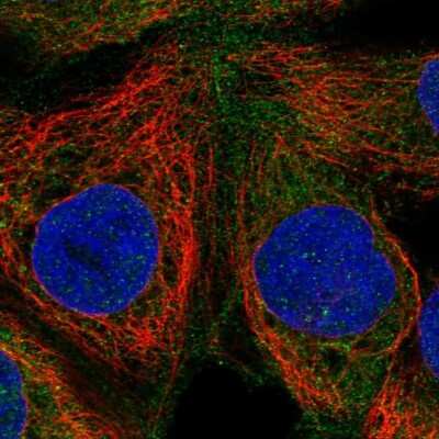 Immunocytochemistry/Immunofluorescence: Rasgrp1 Antibody [NBP2-68636] - Staining of human cell line CACO-2 shows localization to plasma membrane & cytosol.