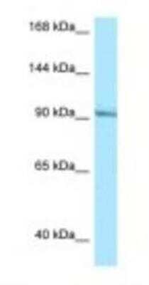 Western Blot: Rasgrp1 Antibody [NBP1-98413] - Jurkat Cell Lysate 1.0ug/ml, Gel Concentration: 6-18%