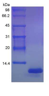 SDS-Page: Rat CX3CL1/Fractalkine Protein [NBP2-35198]