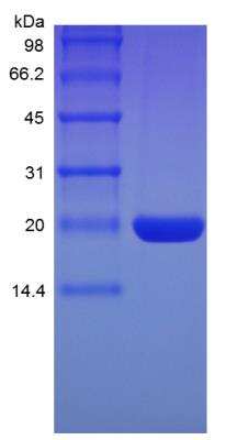 SDS-Page: Rat G-CSF Protein [NBP2-35201]