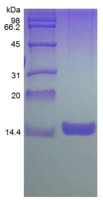 SDS-Page: Rat GM-CSF Protein [NBP2-35206]