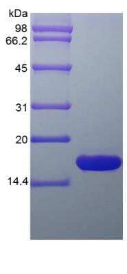 SDS-Page: Rat GMF-beta Protein [NBP2-35207]