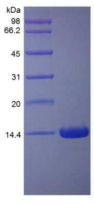 SDS-Page: Rat IFN-gamma Protein [NBP2-35218]