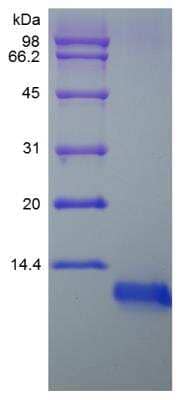 SDS-Page: Rat IGF-I Protein [NBP2-35219]