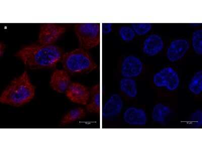 Immunocytochemistry/Immunofluorescence: Rat Pure-Blot anti-Mouse IgG (H+L) Secondary Antibody (eB144) [DyLight 680] [NBP3-11664] - Immunofluorescence microscopy of alpha-tubulin in A431 cells using Rat Pure-Blot anti-Mouse IgG (H+L) Secondary Antibody (eB144) [DyLight 680] for detection. A431 cells were fixed with 100% methanol, blocked (5% rat serum/0.3% Triton X-100 in 1X PBS) for 1 hr, then incubated with 15 ug/mL of anti-alpha-tubulin primary antibody at 4 degrees C overnight. After 3 washes in 1X PBS for 5 min each, 5 ug/mL of Rat Pure-Blot anti-Mouse IgG (H+L) Secondary Antibody (eB144) [DyLight 680] was added and allowed to incubate for 1 hr at room temperature. Nuclei were counterstained with DAPI present in mounting medium. The predicted main localization is microtubules. Image taken at 63X magnification. (a) Merged alpha-tubulin (red)/DAPI (blue) image shown. (b) secondary antibody only.