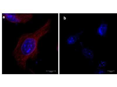 Immunocytochemistry/Immunofluorescence: Rat Pure-Blot anti-Mouse IgG (H+L) Secondary Antibody (eB144) [DyLight 680] [NBP3-11664] - Immunofluorescence microscopy of alpha-tubulin in HeLa cells using Rat Pure-Blot anti-Mouse IgG (H+L) Secondary Antibody (eB144) [DyLight 680]  for detection. HeLa cells were fixed with 100% methanol, blocked (5% rat serum/0.3% Triton X-100 in 1X PBS) for 1hr, then incubated with 15ug/mL of anti-alpha-tubulin primary antibody at 4C overnight. Following 3 washes in 1X PBS for 5 min each, 5ug/mL of Rat Pure-Blot anti-Mouse IgG (H+L) Secondary Antibody (eB144) [DyLight 680] was added and allowed to incubate for 1hr at room temperature. Nuclei were counterstained with DAPI present in mounting medium. The predicted main localization is microtubules. Image taken at 63X magnification. (a) Merged alpha-tubulin (red)/DAPI (blue) image shown. (b) secondary antibody only.